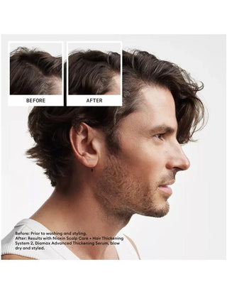 Nioxin-Nioxin System 2 Scalp & Hair Shampoo - 300ml-
