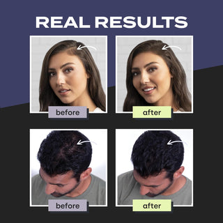 TOPPIK-TOPPIK Hair Building Fibers (Black) - 12g-